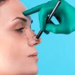 Rhinoplasty