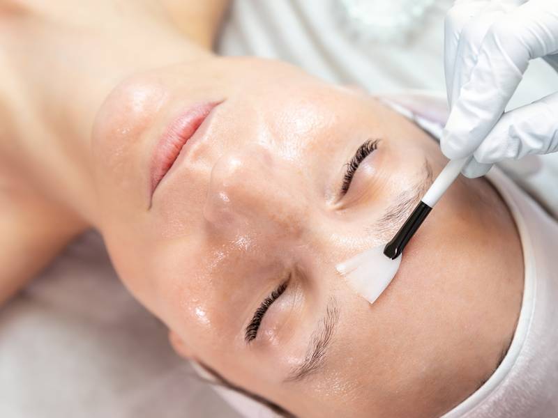 Vi Peel Chemical Peel Guide in East Brunswick New Jersey