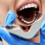 Orthodontist Howard Beach: Your Guide to Achieving a Perfect Smile