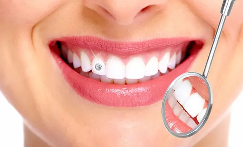 teeth whitening Abu Dhabi