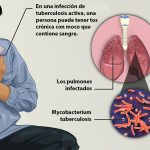 Tuberculosis In India