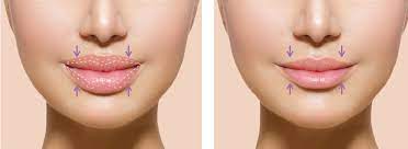 What are the benefits of Haryana’s breast Shrinkage, Lip Slimming, and Lower Lip Tune-Up along with financial considerations?