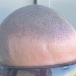 Scalp Micropigmentation: A Modern Solution to Hair Loss